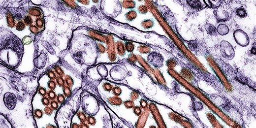 What Doctors Want You to Know About the First Case of Severe Bird Flu