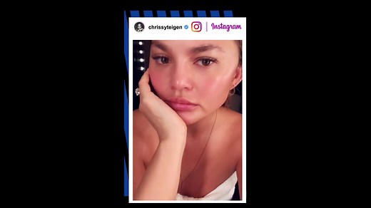 Chrissy Teigen shows off ‘new brow hairs’ following eyebrow transplant