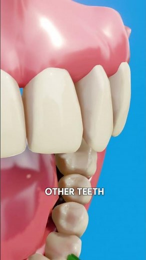 How Dentists Fix a Chipped Tooth