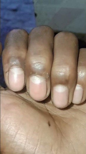 finger lock trick | try this challenge😳