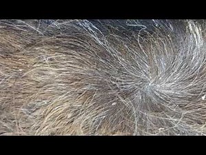 Lice on Horses ~ after winter broke the warmer weather woke up the lice.