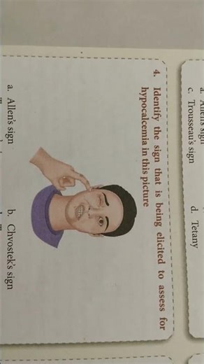 what is the Chvosteks sing #shortvideo #medical #biology #doctor #nursing