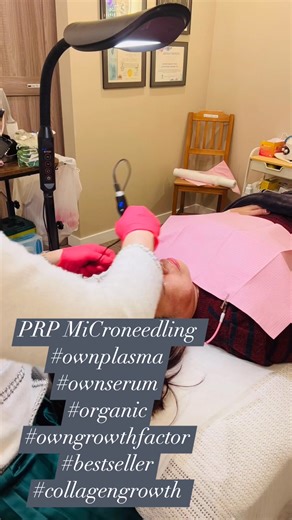 PRP Facial Benefits • Boosts collagen & elastin • Improves skin texture and tone • Reduces fine lines and acne scars • Brightens dull, tired skin • Enhances firmness and glow • Natural rejuvenation using your own blood #yycprpmicroneedling #yycesteticadeespana-calgary #esteticadeesoanph #yycnurseaesthetics Estetica De España-Calgary🇨🇦 403-891-5326 www.estetica-de-espana-calgary.ca Estetica De España PH🇵🇭 0918-9658406 📍1234 Maceda St, Sampaloc, Manila | Estetica De España-Calgary