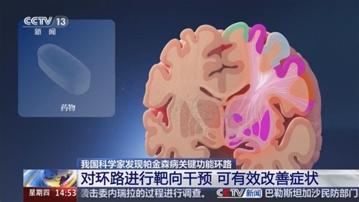 我国科学家发现帕金森病关键功能环路 对环路进行靶向干预 可有效改善症状