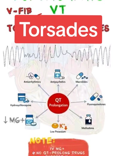 ECG Study Note: Monomorphic vs Polymorphic VT ECG study concept: ventricular tachycardia patterns. Monomorphic VT – uniform wide complexes. Polymorphic VT – varying morphology. Torsades – twisting pattern around baseline. #ecg #cardiology #medicaleducation #nursingstudent #electrophysiology