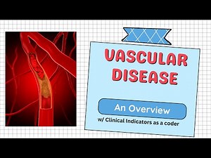 Clinical Indicators for Vascular Disease: A Guide for Risk Adjustment Coders: HCC & MRA Queries