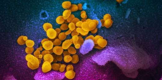 How remdesivir works, and why it's not the ultimate coronavirus killer