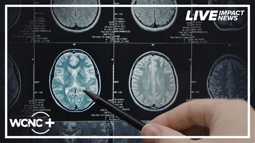 Seeking solutions: Brain health workshop