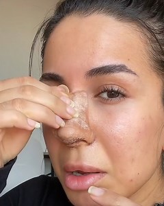 Seeing my new nose for the first time and I am shook by how it looks 👃 | Ultimate