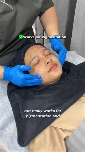 Transform your skin with One Doc’s Ultra Pico X Treatment! ✨ Say goodbye to pigmentation and hello to smoother, brighter, glass-skin radiance. Get ready for an even tone, luminous glow, and skin that feels as good as it looks! 🌟💖 PM us now to book your appointment 📩 *This video reflects the personal experience of the client. Individual results may vary. Visible improvements require regular maintenance. #Ad | One Doc