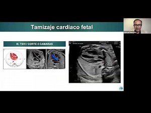 Fetal Congenital Heart Disease Screening: Essential Views and Diagnostic Clues