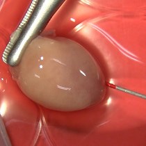 A Langendorff-Free Method for Isolating Mouse | JoVE Journal