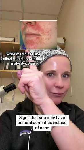 Comment if you have perioral dermatitis. #skincare #dermatologist