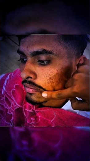 Andha balver!! #shorts #comedy