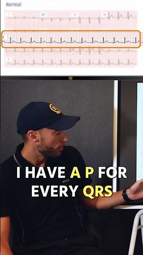 Do This FIRST With Every 12-Lead ECG!