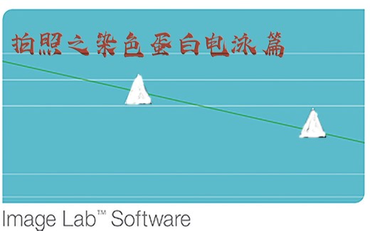 【分子生物学】imagelab拍照之蛋白电泳篇
