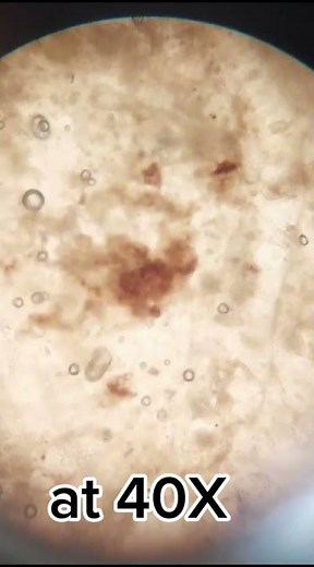 Soft Banana Under the Microscope: What Happens as It Ripens