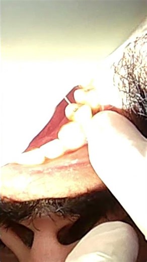 Real-Time Emergency Dental Repair: A Race Against Time