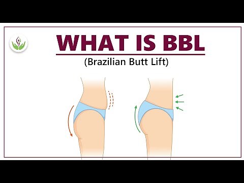 What is a Brazilian Butt Lift (BBL) & How is a Brazilian Butt Lift Done? by Dr Sandeep Bhasin
