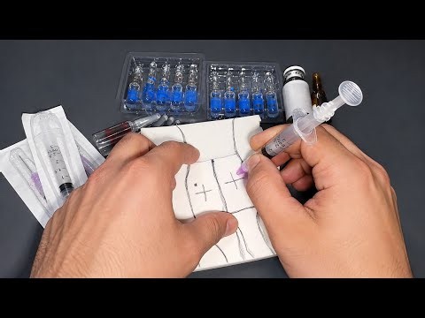 Dorsogluteal IM Injection Technique
