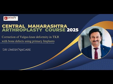 Correction of Valgus knee deformity in TKR with bone defects using primary Implants : Dr Umesh