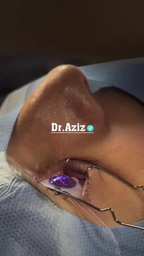 Laser Eye Surgery: Types, Cost, and Risks Explained