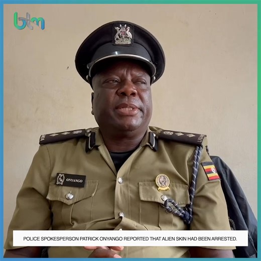 13 reactions | Police spokesperson 'Patrick Onyango' reported that alien skin had been arrested. #btmupdates #btmcommunityreport | BTM TV | Facebook