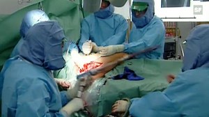 Beispiel einer Hüftoperation