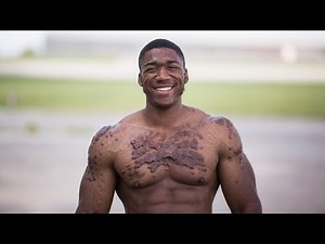 My Scars Won’t Kill My Bodybuilding Dreams | UNBREAKABLE ME