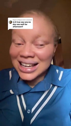 Understanding Light Sensitivity in Albino Eyes