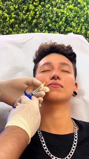 Tratamientos de Rinomodelación y Botox en Costa Rica