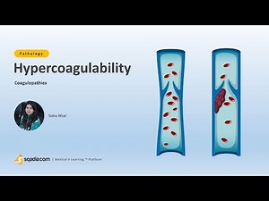 Coagulopathies | Hypercoagulability