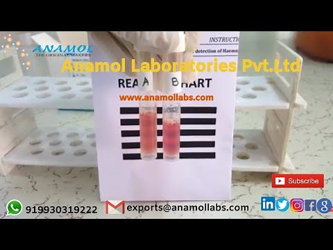 Sickle Cell Anemia Test Procedure