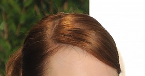 Emma Stone, la beauté flamboyante