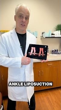 Calf and Leg Liposuction Explained | Dr. Wright on Lipedema & Lower Leg Contouring