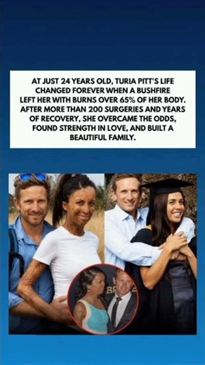 "Turia Pitt: Survived 65% Burns — Built a Beautiful Life & Family