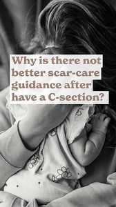 So many women leave hospital after major abdominal surgery without being shown how to care for their scar or told why it matters. Scar tissue needs attention as part of recovery. When it’s ignored, it can contribute to ongoing pain, core weakness and pelvic floor issues later on. You deserve better information and proper support. Learn what to do, when to do it, and how to look after your body after a C-section. Visit our website via the link in bio and follow along for clear, expert guidance th