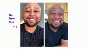 Smile Direct Club TV Spot, 'Scary'