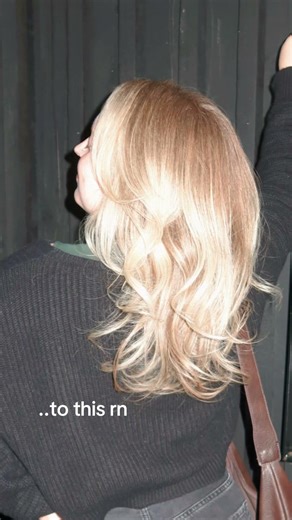 so many good benefits of using this wand for your skin/acne related issues but we can’t skip out on