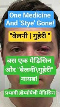 Stye| बेलनी| गुहेरी: Best Homeopathic Treatment| नेचुरल होम्योपैथी मेडिसिन| Dr.Homeocare #ytshorts