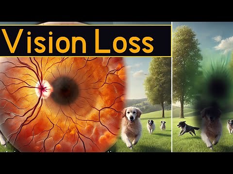 7 Surprising Causes of Vision Loss You Need to Know!
