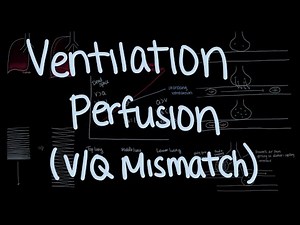 Ventilation and Perfusion Explained (V/Q Mismatch)
