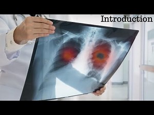 COVID-19 Chest X-RAY Detection using Deep Learning - Introduction Part 1