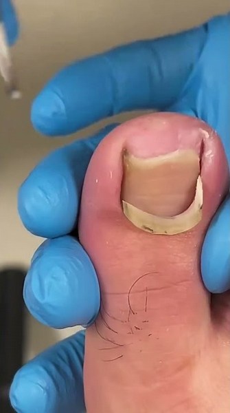 Satisfying pedicure video! #pedicure #toenails