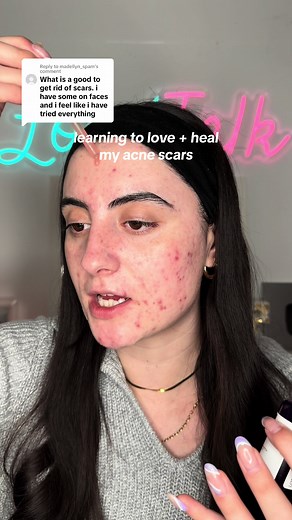 Embracing Progress: My Journey with Acne Scars and La Roche-Posay Mela B3 Serum