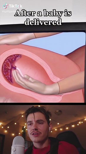 Understanding the Baby Delivery Process in Animation