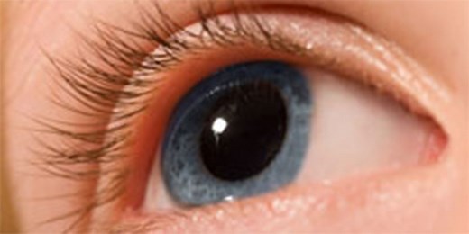What Are Dilating Eye Drops?