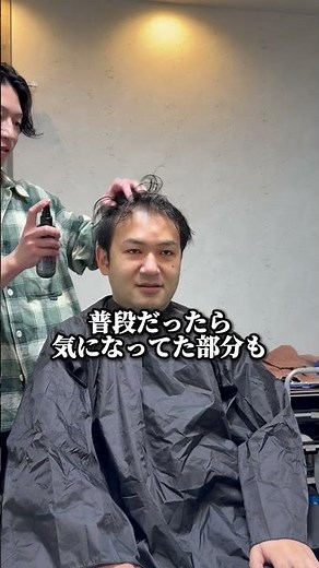生え際を隠したい