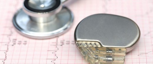 Pacemaker : comment marche ce stimulateur cardiaque ?
