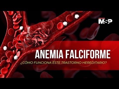 TODO SOBRE ANEMIA FALCIFORME 🩸 | CAUSAS, SÍNTOMAS Y TRATAMIENTOS ACTUALES